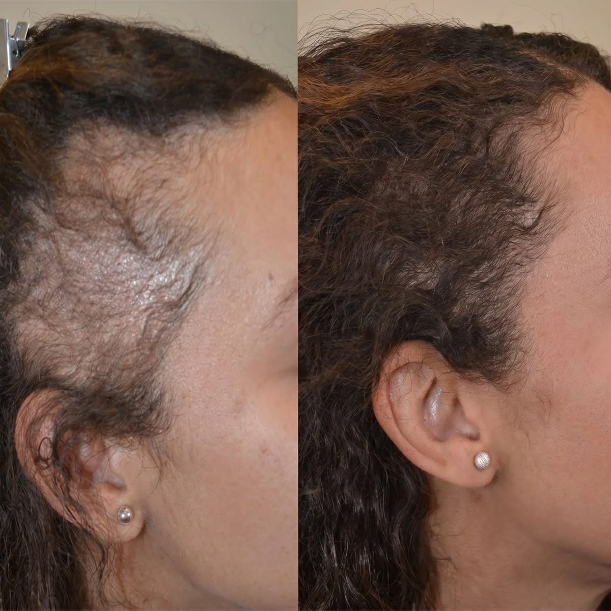 LINIGROW Peptide Hair Growth Serum